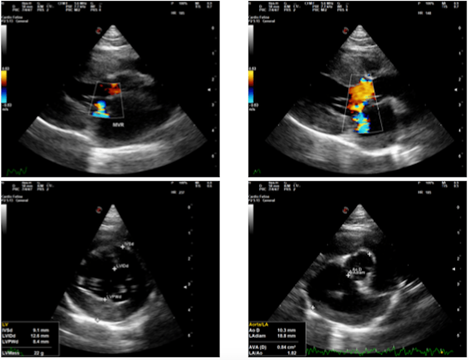 A screen shot of a ultrasound feline echo report