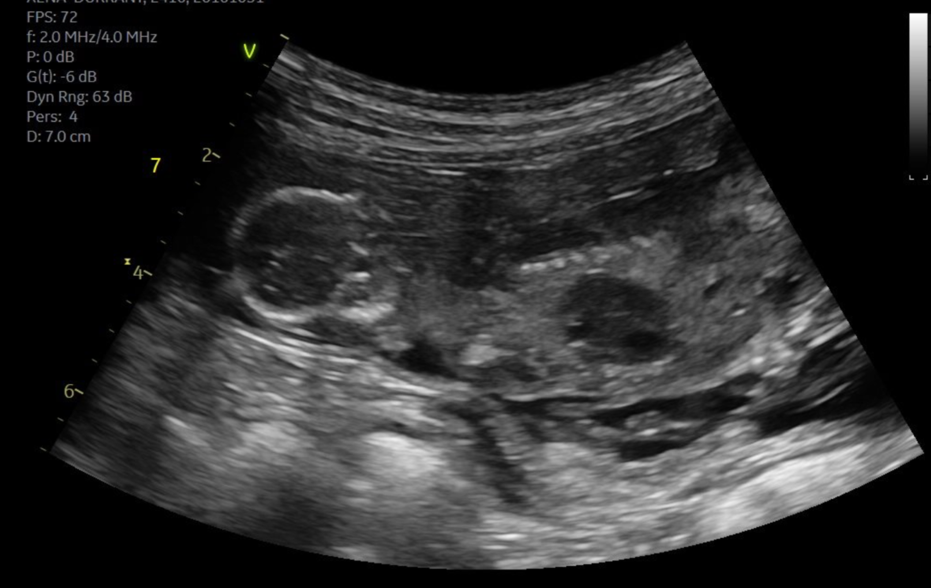 pet other ultrasound