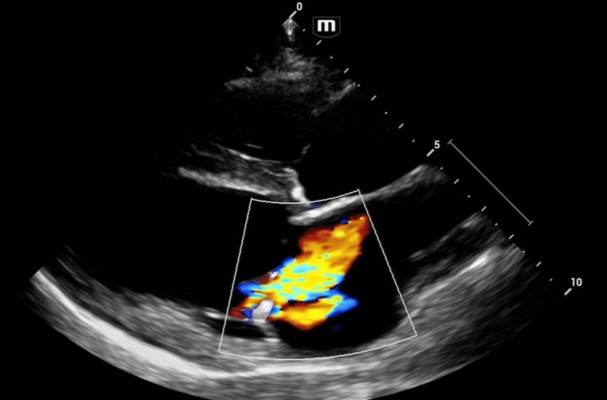 Ultrasound Training for Vets